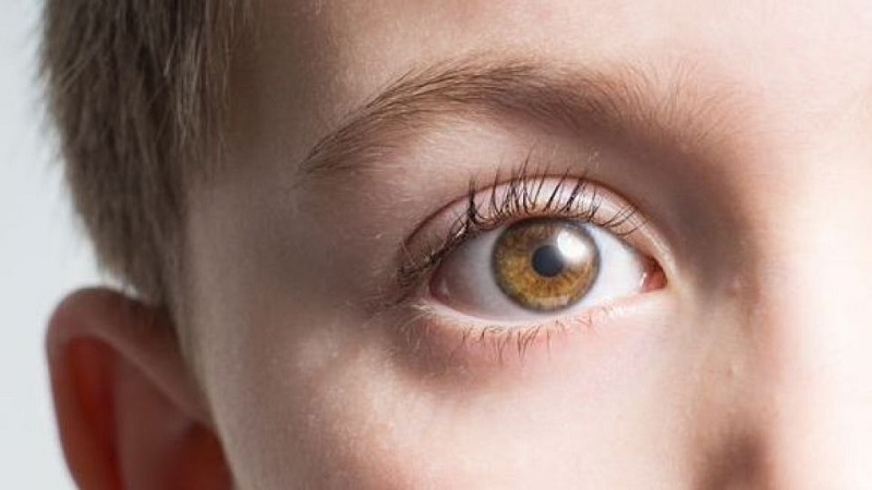 علائم و علل اصلی خشکی چشم | کلینیک شبانه روزی فولادشهر