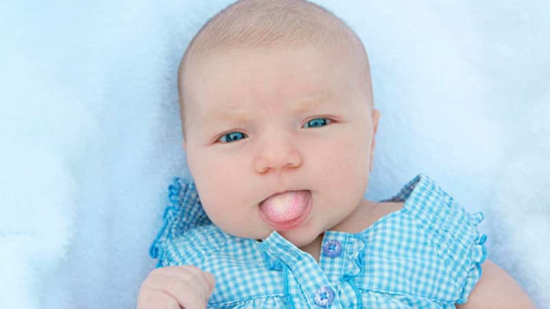 عوامل برفک دهان در نوزادان و بزرگسالان | کلینیک شبانه روزی فولادشهر